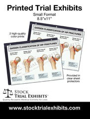 Printed Small Format Garden Classification of Hip Fractures Trial Exhibit
