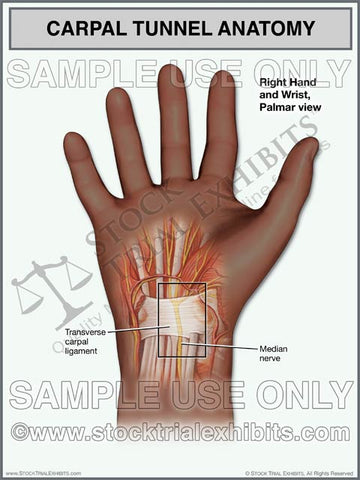 Carpal Tunnel Anatomy, Normal Right Wrist (African American)