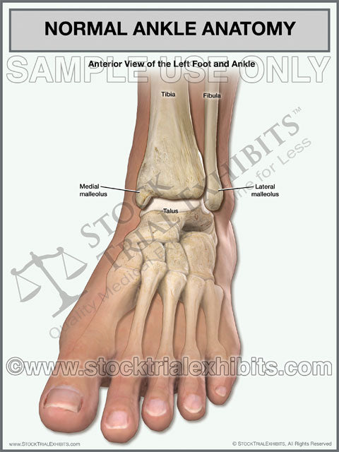 normal anatomy of the left ankle stock medical illustration trial exhibit, Normal ankle anatomy, anatomy of foot and ankle, anatomy of left ankle , medical legal illustration, medical legal exhibit of ankle anatomy, ankle anatomy normal