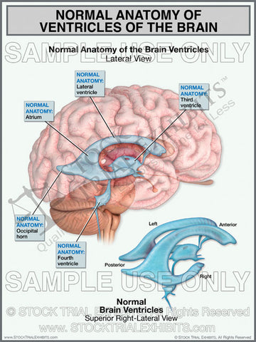 Brain Ventricles Normal Anatomy