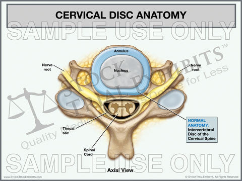 Cervical Disc Explination Cervical Disc Anatomy Normal (Axial View) – Stock Trial Exhibits
