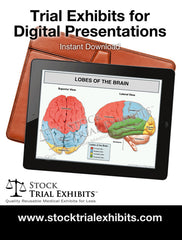Digital Presentation Lobes of the Brain Trial Exhibit