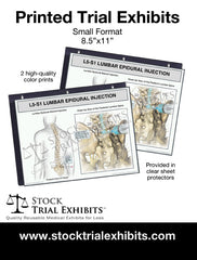 L4-L5 Epidural Injection of Lumbar Spine Trial Exhibit (Male)
