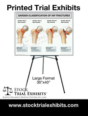 Printed Large Format Garden Classification of Hip Fractures Trial Exhibit