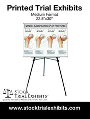 Printed Medium Format Garden Classification of Hip Fractures Trial Exhibit