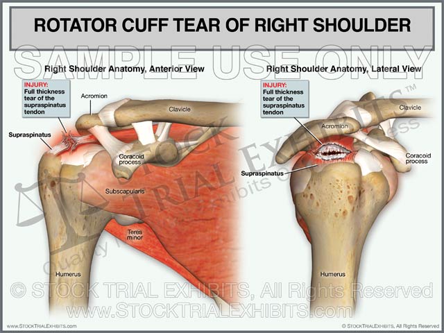Anatomy Of The Right Shoulder