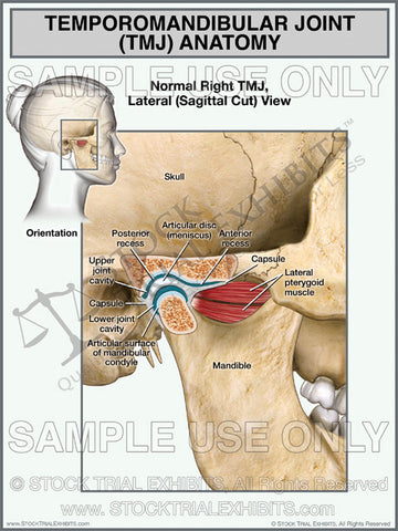 TMJ Normal Anatomy Female