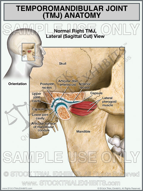This trial exhibit depicts the normal anatomy of the TMJ or Temporomandibular Joint anatomy, shown with lateral male orientation and close up sagittal cut view of TMJ anatomy. TMJ anatomy labels point to all relevant anatomical structures for easy identification.
