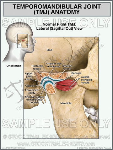 TMJ Normal Anatomy Male